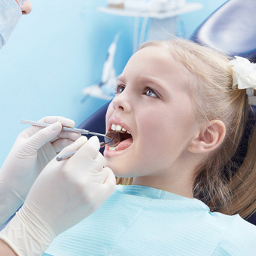 Lakowanie zębów - Stomatologia Perfektdent Białołęka i Tarchomin